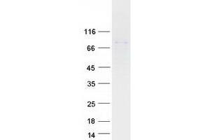 Western Blotting (WB) image for Tudor Domain Containing 3 (TDRD3) protein (Myc-DYKDDDDK Tag) (ABIN2733394)