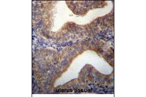 SLC29A3 Antibody (N-term) (ABIN656792 and ABIN2846011) immunohistochemistry analysis in formalin fixed and paraffin embedded human uterus tissue followed by peroxidase conjugation of the secondary antibody and DAB staining. (SLC29A3 抗体  (N-Term))