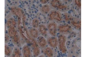 IHC-P analysis of Rat Kidney Tissue, with DAB staining. (CUBN 抗体  (AA 3511-3623))