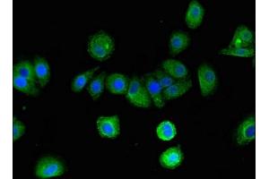 Immunofluorescent analysis of HepG2 cells using ABIN7145448 at dilution of 1:100 and Alexa Fluor 488-congugated AffiniPure Goat Anti-Rabbit IgG(H+L) (Arrestin 3 抗体  (AA 222-369))