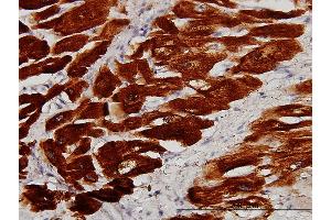 Immunoperoxidase of monoclonal antibody to TNNC1 on formalin-fixed paraffin-embedded human heart. (TNNC1 抗体  (AA 1-161))