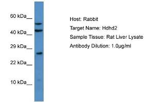 Host: Rabbit Target Name: Hdhd2 Sample Type: Rat Liver lysates Antibody Dilution: 1. (HDHD2 抗体  (N-Term))