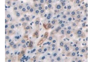 Detection of DLD in Rat Liver Tissue using Polyclonal Antibody to Dihydrolipoyl Dehydrogenase (DLD) (DLD 抗体)