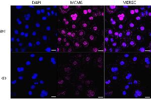 Immunocytochemical staining of HeLa cells using MCM6 antibody (ABIN7799421), 1:1,000), Top panel: wild-type (WT), Bottom panal: MCM6 shRNA knockdown (KD). (Recombinant MCM6 抗体)
