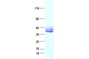 Western Blotting (WB) image for Interleukin 12 beta (IL12B) protein (DYKDDDDK Tag) (ABIN2723603)