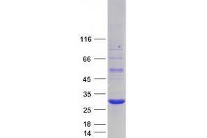Validation with Western Blot