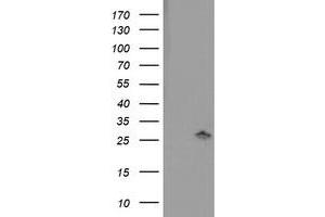 Western Blotting (WB) image for anti-Pyridoxamine 5'-Phosphate Oxidase (PNPO) antibody (ABIN1500320) (PNPO 抗体)