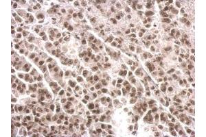Immunohistochemistry (IHC) image for anti-Cofactor of BRCA1 (COBRA1) (Center) antibody (ABIN2855267)