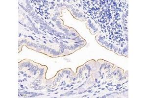 Immunohistochemistry analysis of paraffin-embedded rat colon using,TSPAN1 (ABIN7075867) at dilution of 1: 4000 (TSPAN1 抗体)
