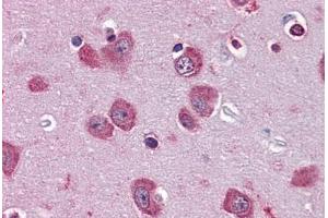 Human Brain, Cortex: Formalin-Fixed, Paraffin-Embedded (FFPE) (PER2 抗体  (AA 1-101))