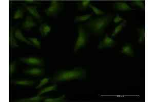 Immunofluorescence of monoclonal antibody to BOLL on HeLa cell.