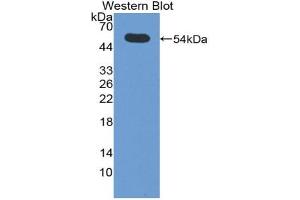 Western blot analysis of the recombinant protein. (SIAE 抗体  (AA 22-244))