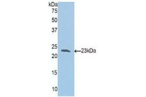 Western blot analysis of recombinant Human Slit1. (SLIT1 抗体  (AA 647-835))