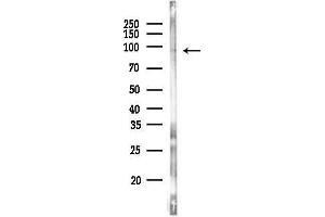 anti-Interleukin enhancer-binding factor 3 (ILF3) (Internal Region) antibody