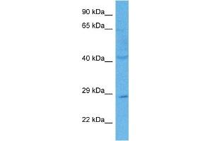 Host:  Rabbit  Target Name:  C21ORF58  Sample Tissue:  Human PANC1 Whole Cell lysates  Antibody Dilution:  1ug/ml (C21orf58 抗体  (N-Term))