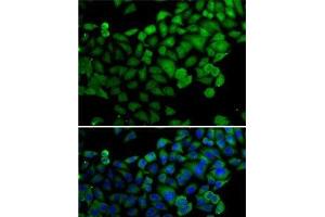 Immunofluorescence analysis of A-549 cells using SYNCRIP Polyclonal Antibody (SYNCRIP 抗体)