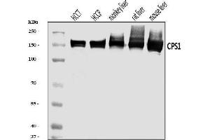 Western blot analysis of CPS1 using anti-CPS1 antibody (ABIN7599871).