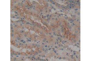 Used in DAB staining on fromalin fixed paraffin- embedded kidney tissue (PTPRE 抗体  (AA 346-500))