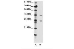 Image no. 1 for anti-Chromobox Homolog 8 (CBX8) (C-Term) antibody (ABIN202404) (CBX8 抗体  (C-Term))