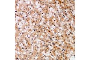 Immunohistochemical analysis of SOCS2 staining in human liver formalin fixed paraffin embedded tissue section. (SOCS2 抗体)