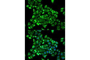 Immunofluorescence analysis of MCF-7 cells using CDA antibody (ABIN5971047). (CDA 抗体)