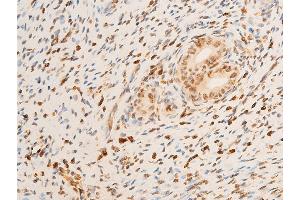 Immunohistochemistry (IHC) image for anti-Neurotrophic Tyrosine Kinase, Receptor, Type 1 (NTRK1) (pTyr681), (Tyr680) antibody (ABIN6256787)