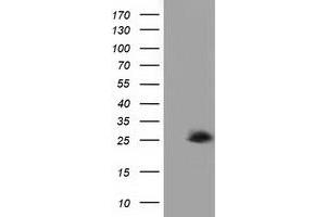 HEK293T cells were transfected with the pCMV6-ENTRY control (Left lane) or pCMV6-ENTRY AK3 (Right lane) cDNA for 48 hrs and lysed. (Adenylate Kinase 3 抗体)