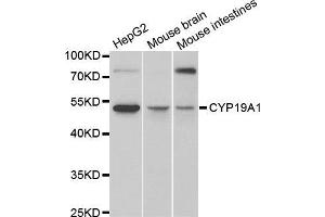 Western blot analysis of extracts of various cell lines, using CYP19A1 antibody (ABIN5971188) at 1/1000 dilution. (Aromatase 抗体)