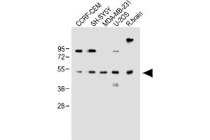 All lanes : Anti-EDIL3 Antibody (Center) at 1:1000 dilution Lane 1: CCRF-CEM whole cell lysate Lane 2: SH-SY5Y whole cell lysate Lane 3: MDA-MB-231 whole cell lysate Lane 4: U-2OS whole cell lysate Lane 5: Rat brain whole lysate Lysates/proteins at 20 μg per lane. (EDIL3 抗体  (AA 337-365))