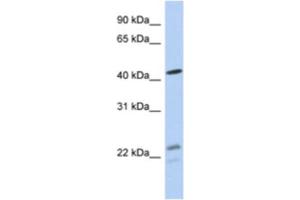 Western Blotting (WB) image for anti-Branched Chain Keto Acid Dehydrogenase E1, alpha Polypeptide (BCKDHA) antibody (ABIN2463953) (BCKDHA 抗体)
