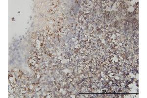Immunostaining (ISt) image for anti-Testis Derived Transcript (3 LIM Domains) (TES) (AA 1-421) antibody (ABIN565232)