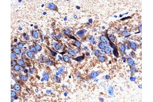Immunohistochemical staining on a rat brain section for Syntaxin 6. (Syntaxin 6 抗体  (AA 6-136))