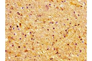 Immunohistochemistry of paraffin-embedded human brain tissue using ABIN7147463 at dilution of 1:100 (LASS1 抗体  (AA 1-52))