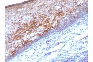Formalin-fixed, paraffin-embedded human Tonsil stained with MCAM Mouse Monoclonal Antibody (MCAM/1101). (MCAM 抗体)