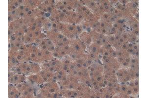 DAB staining on IHC-P; Samples: Human Liver Tissue (LRP5L 抗体  (AA 7-238))