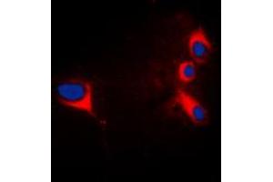 Immunofluorescent analysis of cTnI staining in HepG2 cells. (TNNI3 抗体  (N-Term))