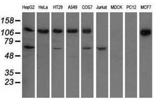 Image no. 2 for anti-Insulin-Like Growth Factor 2 mRNA Binding Protein 2 (IGF2BP2) antibody (ABIN1498824) (IGF2BP2 抗体)
