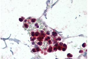 Human Colon, Neutrophils (formalin-fixed, paraffin-embedded) stained with NCF1 antibody ABIN337093 at 5 ug/ml followed by biotinylated anti-goat IgG secondary antibody ABIN481715, alkaline phosphatase-streptavidin and chromogen. (NCF1 抗体  (AA 378-390))