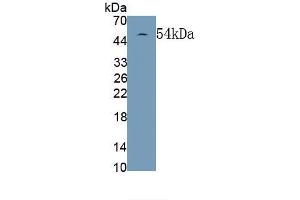 Detection of Recombinant GFAP, Rat using Monoclonal Antibody to Glial Fibrillary Acidic Protein (GFAP) (GFAP 抗体  (AA 1-430))