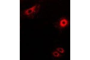 Immunofluorescent analysis of Secretogranin-2 staining in MCF7 cells. (SCG2 抗体)