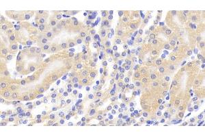 Detection of CASP1 in Mouse Kidney Tissue using Polyclonal Antibody to Caspase 1 (CASP1) (Caspase 1 抗体  (AA 119-296))