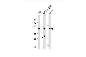 All lanes : Anti-NSFL1C Antibody (N-Term) at 1:2000 dilution Lane 1: 293 whole cell lysate Lane 2: NCI- whole cell lysate Lane 3: A431 whole cell lysate Lysates/proteins at 20 μg per lane.