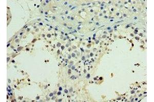 Immunohistochemistry (IHC) image for anti-Nuclear Receptor Subfamily 2, Group C, Member 2 (NR2C2) (AA 240-380) antibody (ABIN7161904)