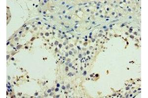 Immunohistochemistry of paraffin-embedded human testis tissue using ABIN7161904 at dilution of 1:100 (TR4 抗体  (AA 240-380))
