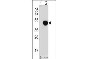 Western blot analysis of LRG1 (arrow) using rabbit polyclonal LRG1 Antibody (N-term) (ABIN652229 and ABIN2840955). (LRG1 抗体  (N-Term))
