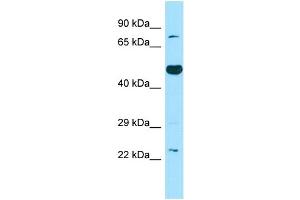 WB Suggested Anti-TBXAS1 Antibody Titration: 1. (TBXAS1 抗体  (C-Term))