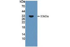 Figure. (RPS6KB1 抗体  (AA 91-352))