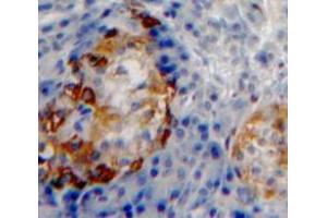 Used in DAB staining on fromalin fixed paraffin-embedded Pancreas tissue (PPY 抗体  (AA 31-97))