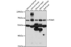 Western blot analysis of extracts of various cell lines, using PGM3 antibody (ABIN7269313) at 1:1000 dilution. (Phosphoglucomutase 3 抗体  (AA 1-300))