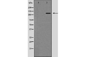 Western blot analysis of JAK1 expression in EGF treated MCF7 whole cell lysates,The lane on the left is treated with the antigen-specific peptide. (JAK1 抗体)